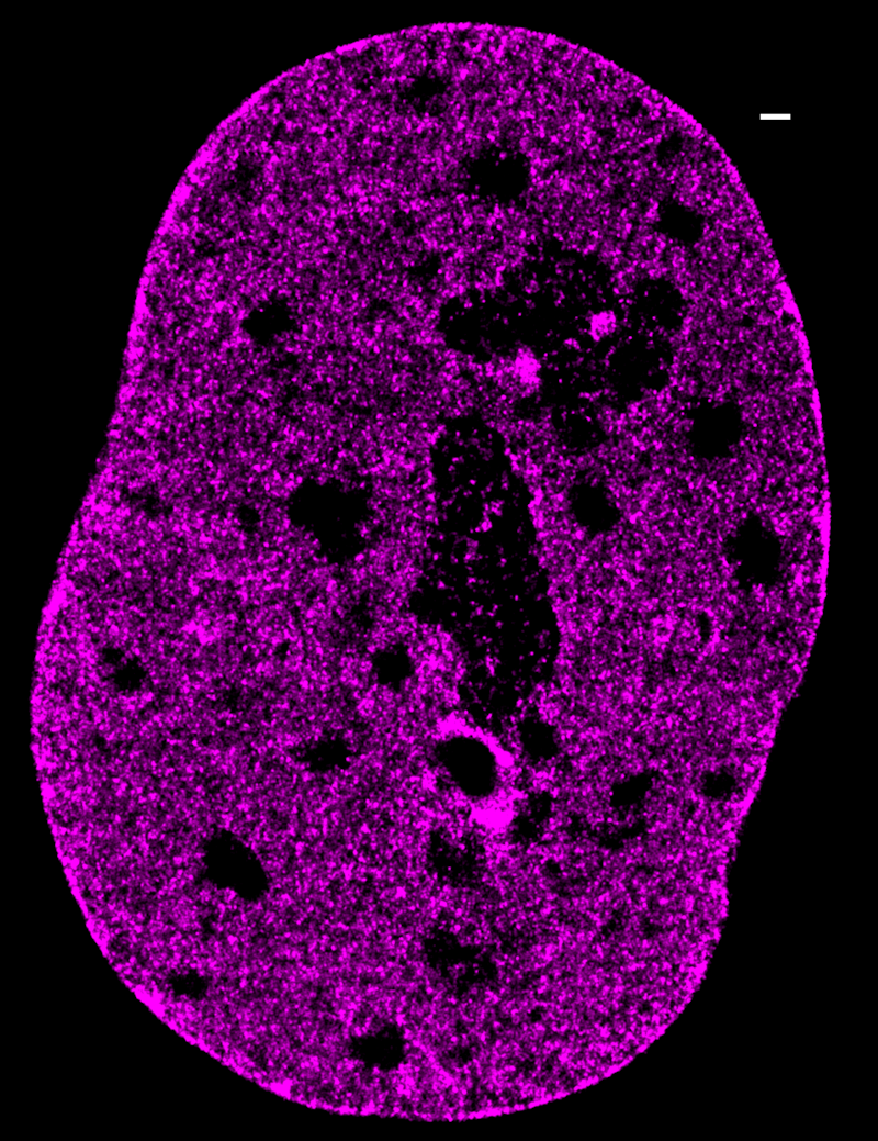 Human nucleus imaged with STORM super-resolution imaging